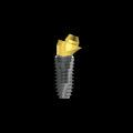 Angled Screw Abutment | 5.5mm Diameter | Super Line | Dentium