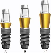 Combi Abutment | Super Line | Standard | Dentium | ImplantsKart
