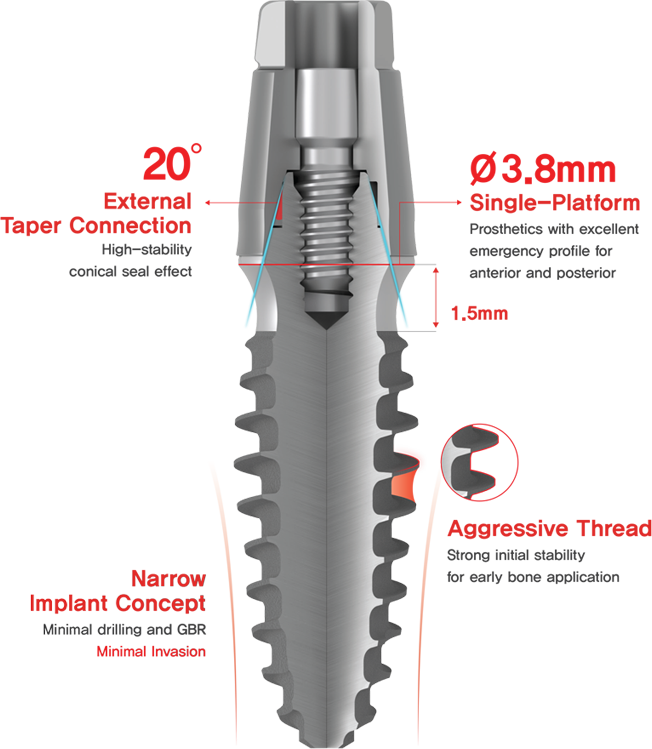 Dental Implant | Tissue Level | Bright | Dentium