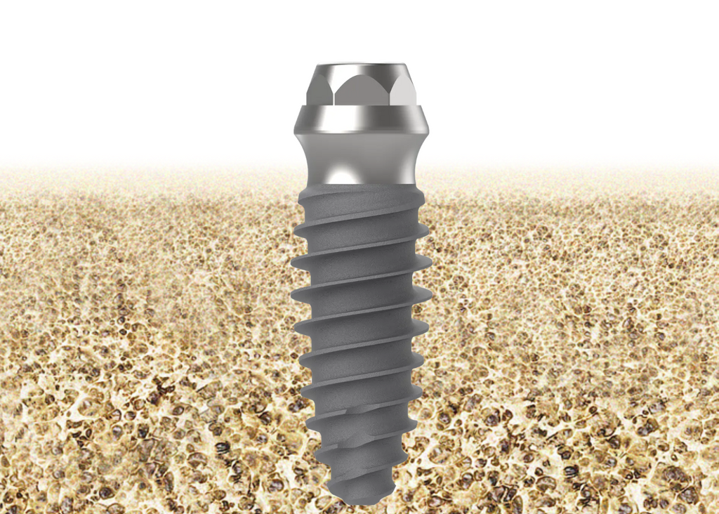 Dental Implant | Tissue Level | Bright | Dentium