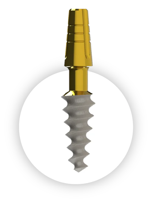Compressive Implant | C-Series | I-Fix | One Piece Implant | ImplantsKart