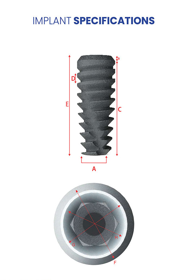 Dental Implant | SP-Series | I-Fix | Without Abutment | ImplantsKart