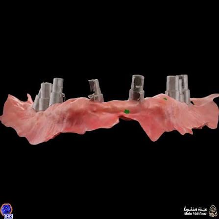 Multiunit Scan Body / Abutment