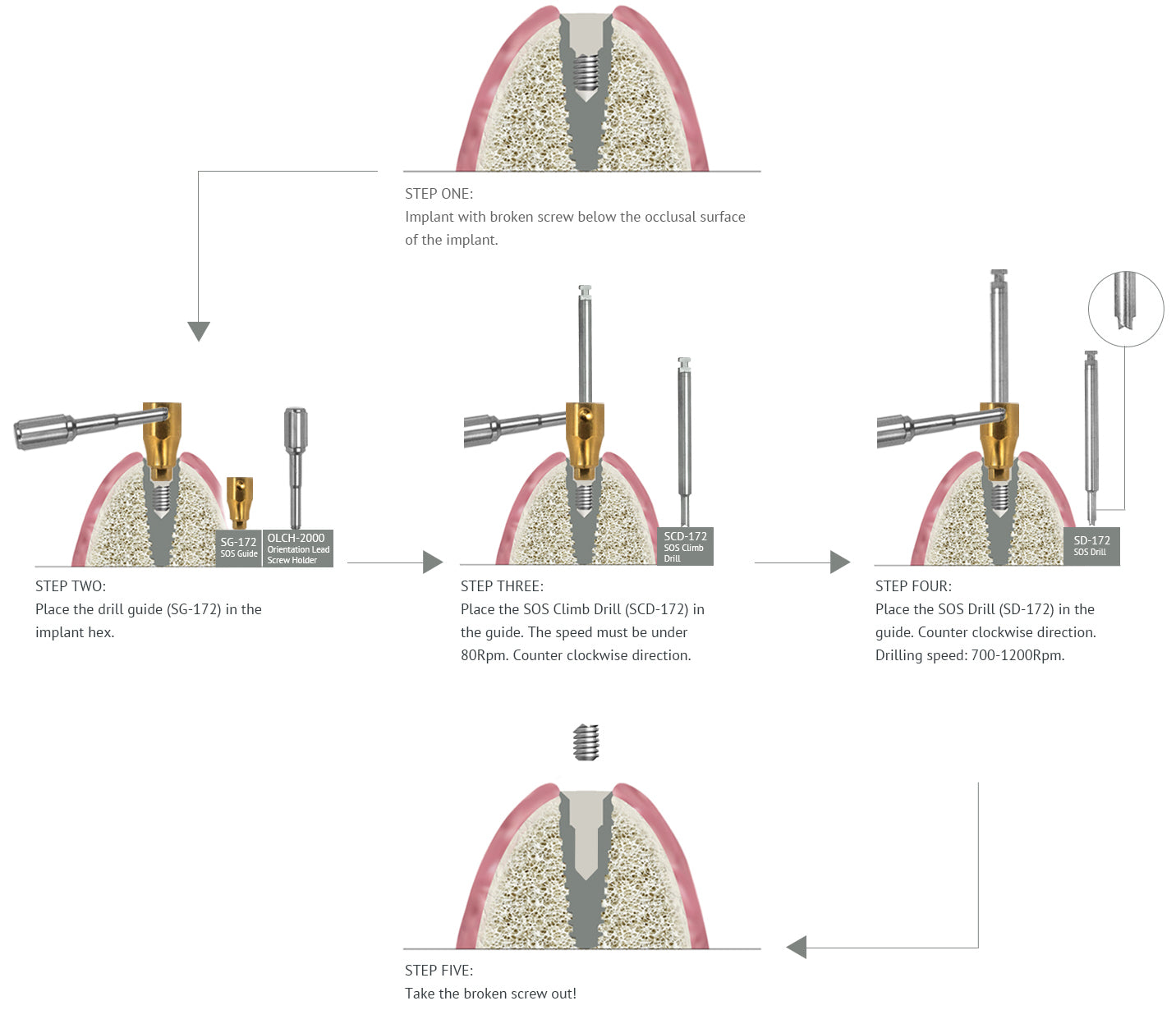 SOS Broken Screw Kit | Surgical | Seven & Lance Plus Compatible | MIS