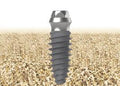 Dental Implant | Tissue Level | Bright | Dentium