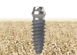 Dental Implant | Tissue Level | Bright | Dentium