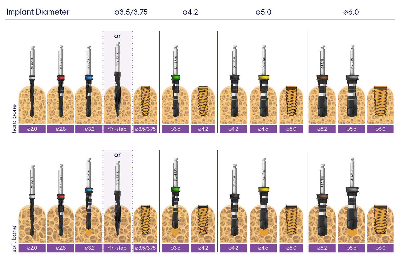 ADIN Swell Dental Implant | Without Abutment | ImplantsKart
