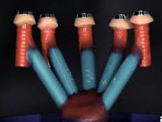 Castable Abutment